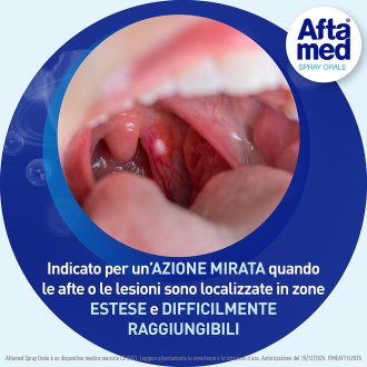 Aftamed Spray Orale Lenitivo Calmante Anti-Irritazioni - Per il trattamento delle afte - 20 ml