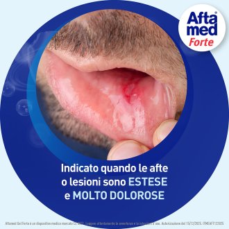 Aftamed Gel Forte - Per il trattamento di afte estese e molto dolorose - 8 ml