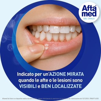 Aftamed Gel - Contro le afte - 10 ml