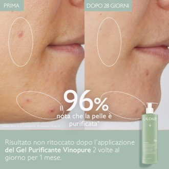 Vinopure Gel Detergente 2023