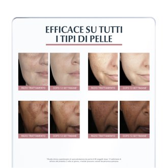 Eucerin Anti Pigment Correttore Antimacchie - Correttore viso contro le macchie scure - 5 ml