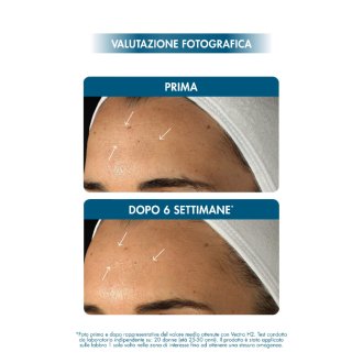 Miamo Hyaluron14+ Fusion Serum - Siero viso anti-rughe rimpolpante - 10 ml Miamo Hyaluron14+ Fusion Serum - Siero viso anti-rughe rimpolpante - 10 ml