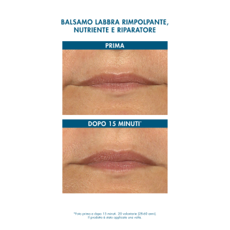 Miamo Hyalu-Repair Lip Balm - Balsamo labbra volumizzante e nutriente - 15 ml - Aroma Frutti Tropicali - Limited Edition Miamo Hyalu-Repair Lip Balm - Balsamo labbra volumizzante e nutriente - 15 ml - Aroma Frutti Tropicali - Limited Edition