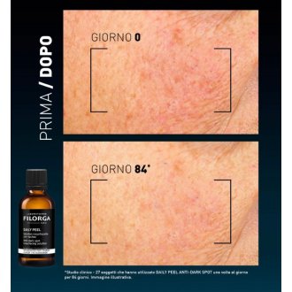 Filorga Daily Peel Anti-Dark Spot - Esfoliante liquido anti-macchie - 50 ml