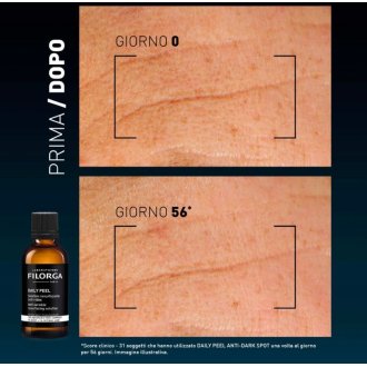 Filorga Daily Peel Anti-Wrinkles - Esfoliante liquido anti-rughe - 50 ml