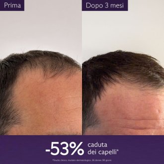 Caudalie Siero Capelli Anticaduta - Siero contro la caduta temporanea dei capelli - 50 ml